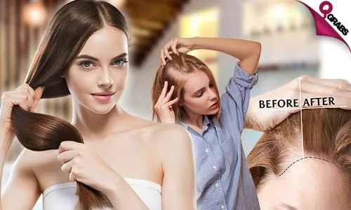 Ladies' Hair Treatments: Hair Loss, Dry Hair OR Anti-Dandruff!